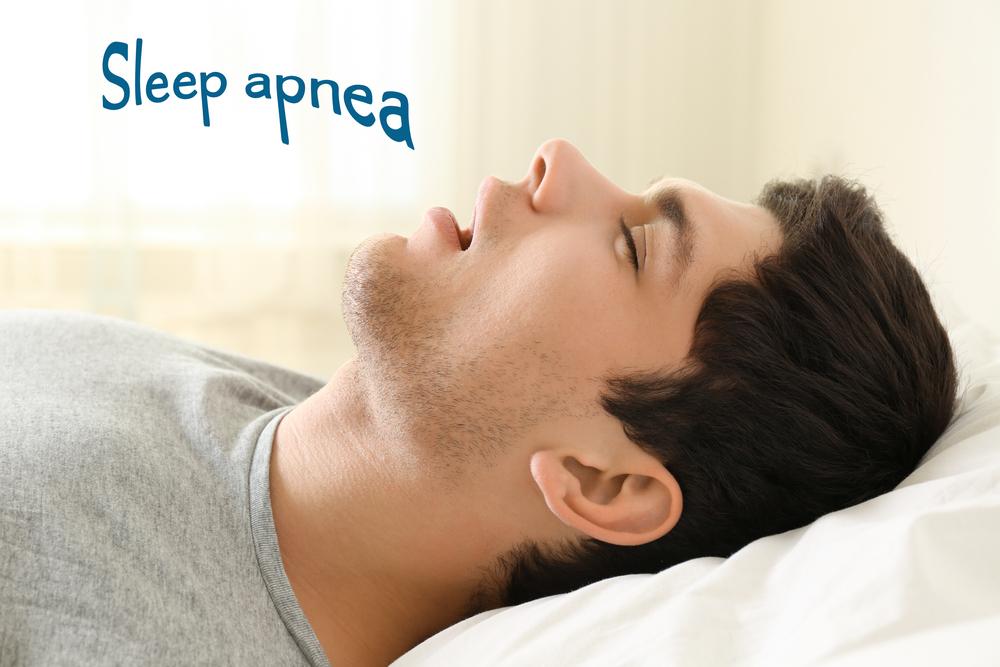 Overview &#8211; Snoring and Sleep Apnea