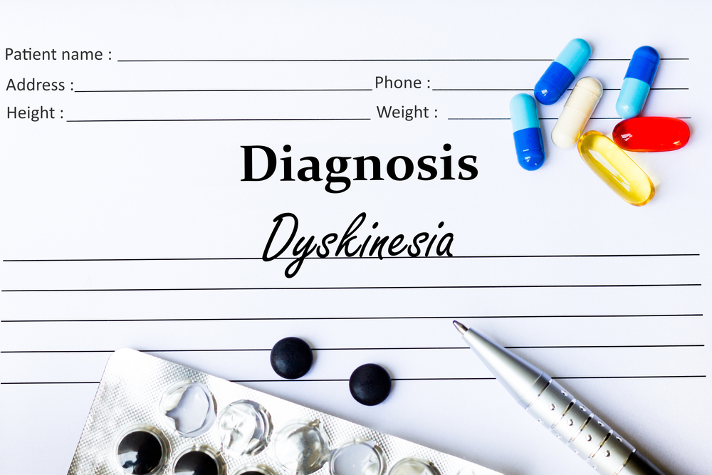 Diagnosis and Treatment Options for Dyskinesia