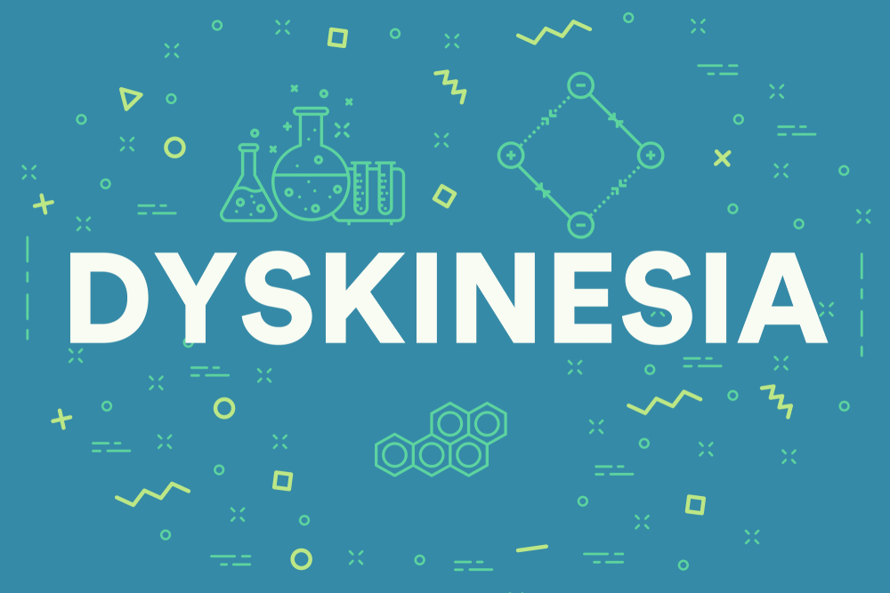 Overview and Causes of Dyskinesia