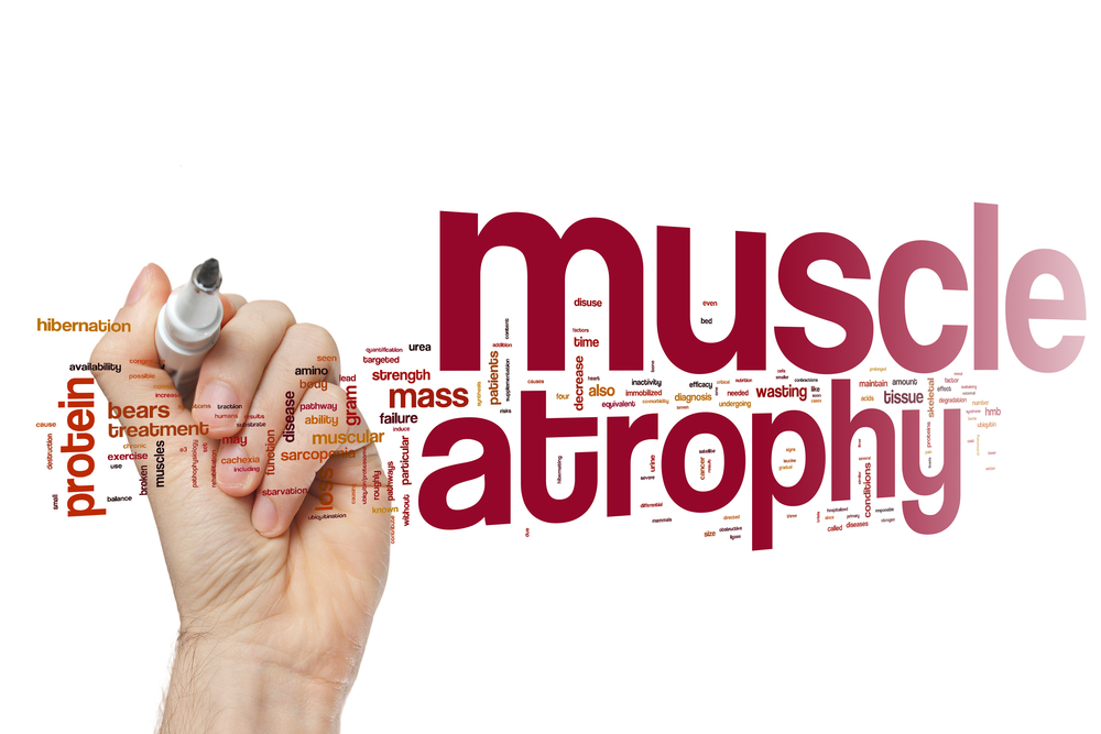 Signs and Symptoms of Muscle Atrophy