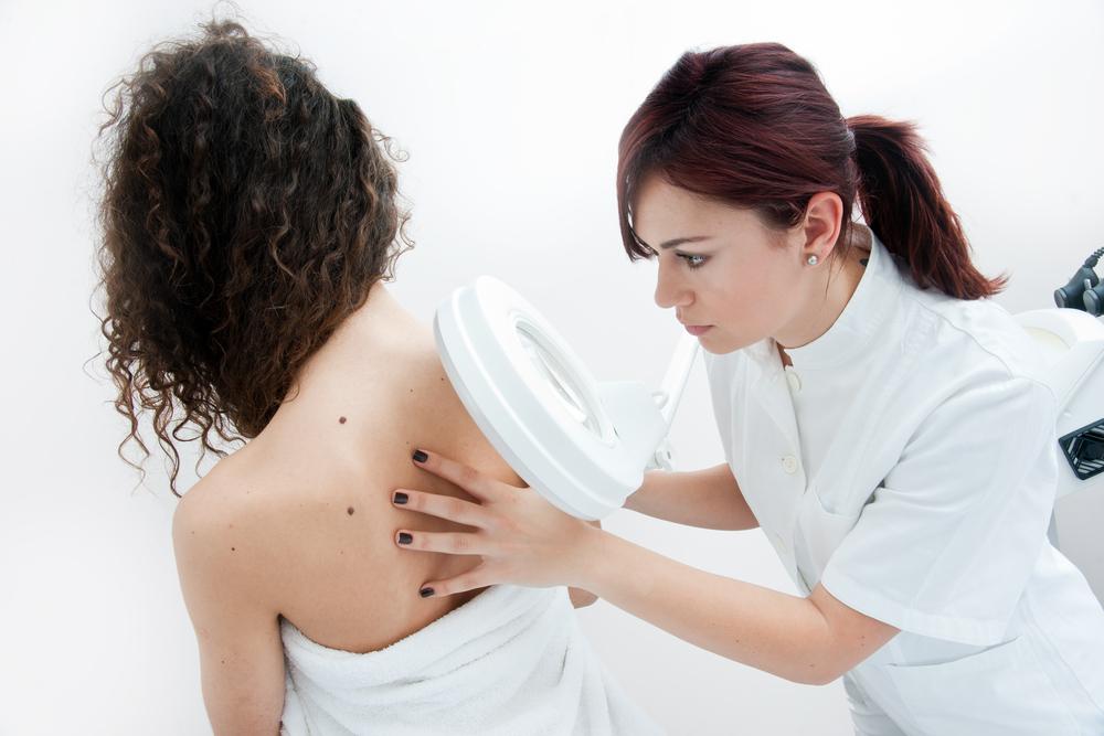 Symptoms and Prevention of Melanoma