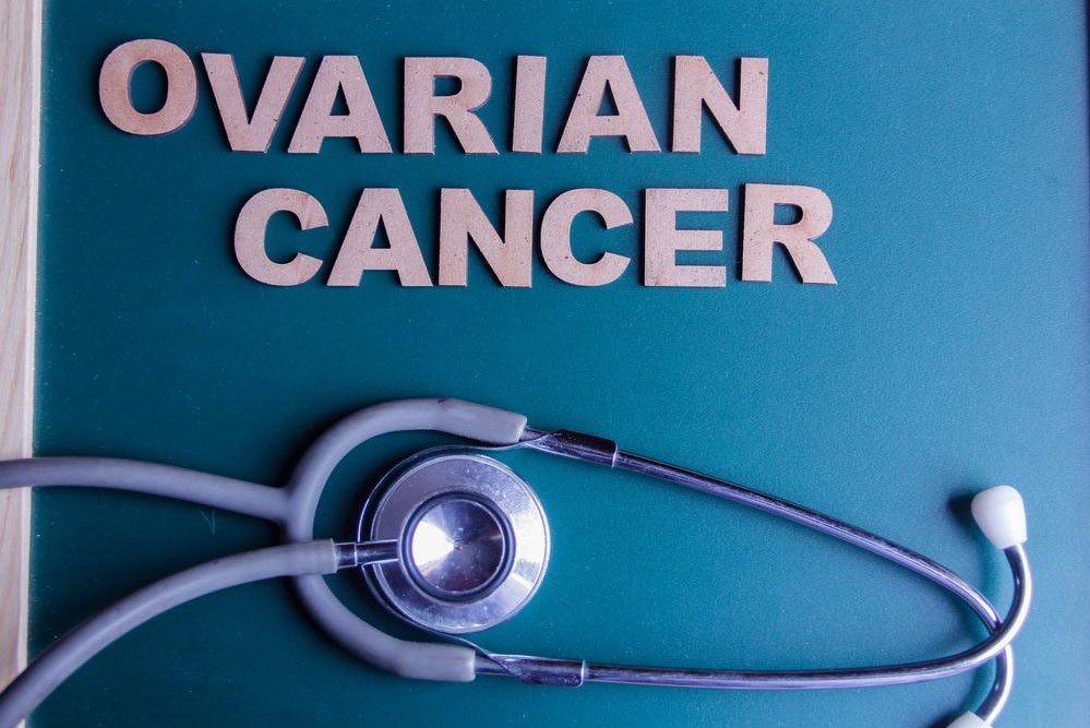 Treatment Options and Survival Rates of Ovarian Cancer